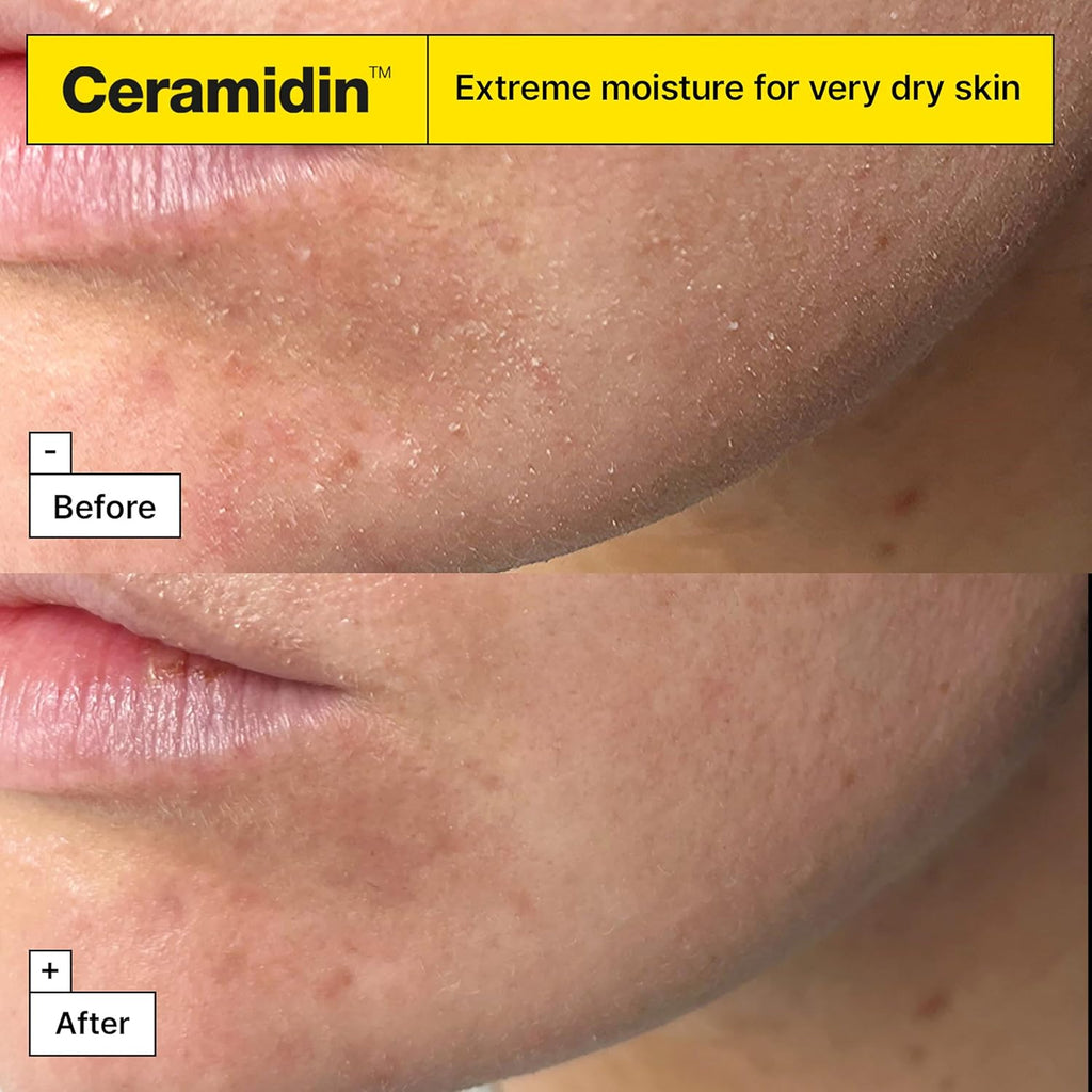 Dr.Jart+ Ceramidin Ectoin-Infused Korean Face Cream Moisturizer for Dry Skin | Korean Skin Care, 1.69 Fl Oz